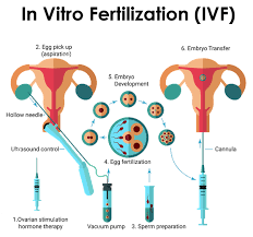 IVF (In-Vitro Fertilization), IVF advantages and disadvantages, IVF procedure, IVF cost in India, Precautions before and after IVF, IVF success factors